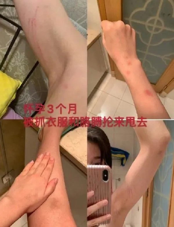 张培萌妻子谈产后第17天被家暴 张培萌打妻子视频曝光