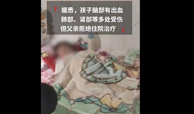 妇联启动坠楼女婴救助程序 坠楼女婴父亲回应拒绝治疗