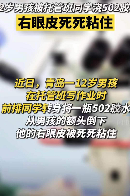 12岁男孩被托管班同学浇502胶水 怎么除502胶小窍门