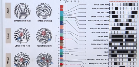 研究发现指纹与身体发育基因关联 手通过指纹可发现唐氏综合征