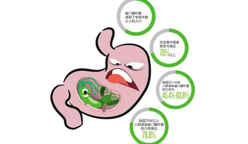 45岁女子感染幽门螺杆菌致胃癌 感染了幽门螺杆菌一定会得胃癌吗