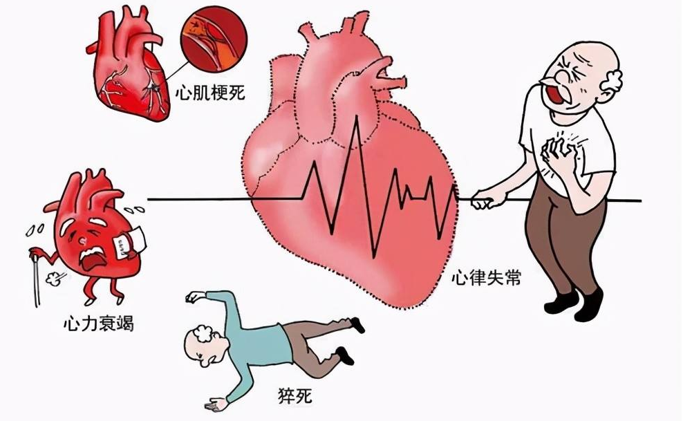 27岁男子打游戏到凌晨3点突发心梗 凌晨3点27岁男子打游戏突发心梗